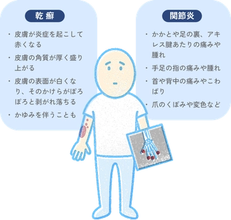 乾癬性関節炎の症状を示した図で、皮膚の炎症や厚み、かゆみに加え、足や指、首などの関節の痛みや腫れ、爪の変色などを解説。