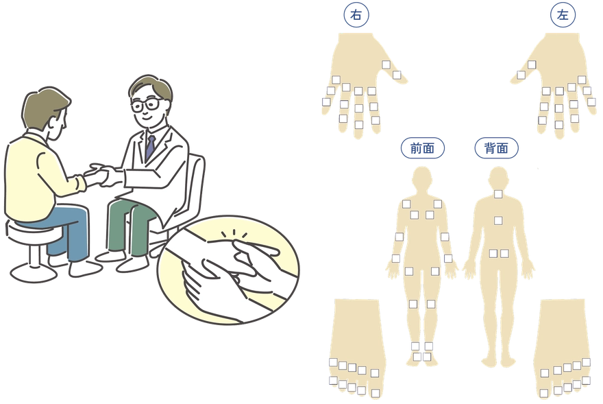 押さえたときに痛みのある関節や腫れている関節を診察前にチェックするための図。
