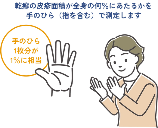 皮疹面積について手のひら1枚分が全身の1%に相当する事を示した図。